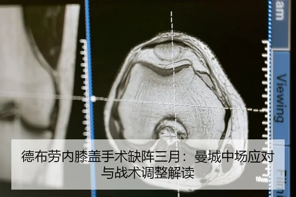 de-bu-lao-nei-xi-gai-shou-shu-que-zhen-san-yue-man-cheng-zhong-chang-ying-dui-yu-zhan-shu-tiao-zheng-jie-du-2-996.jpg